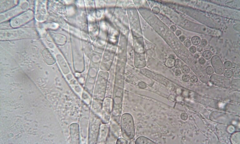 Salud confirma 33 casos de ciclosporiasis en México; descartan evidencia de que el brote en EE.UU. se originara en el país
